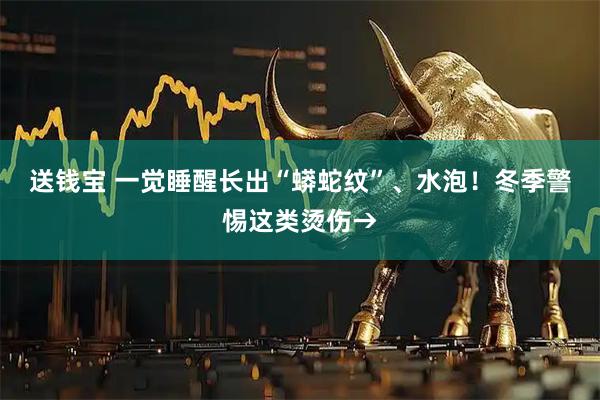 送钱宝 一觉睡醒长出“蟒蛇纹”、水泡！冬季警惕这类烫伤→